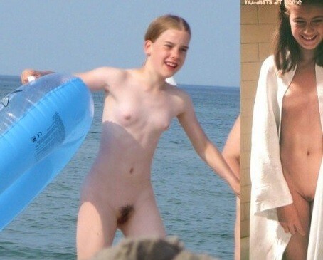 Bare Lake Days photos - A life free of unnecessary worries is a hallmark of naturism